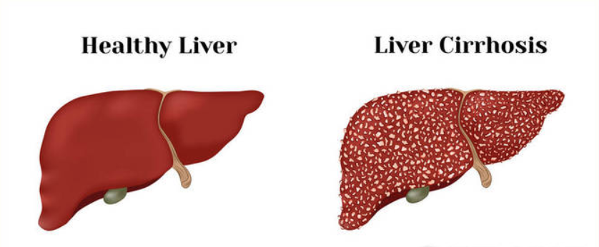 成人脂肪干細胞存儲 成人脂肪干細胞存儲