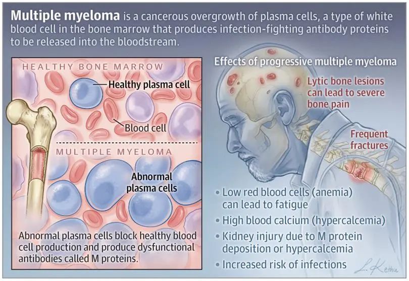 免疫細胞儲存 免疫細胞儲存