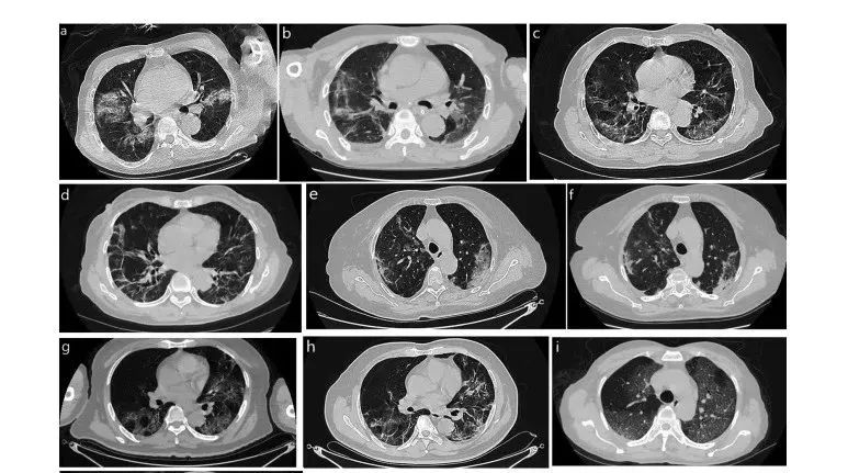干細胞存儲 干細胞存儲