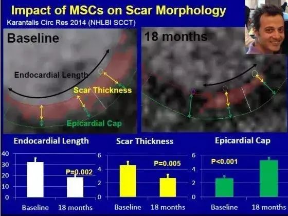 脂肪干細胞儲存 脂肪干細胞儲存