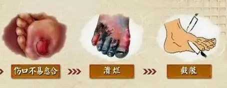 干細胞存儲 干細胞存儲