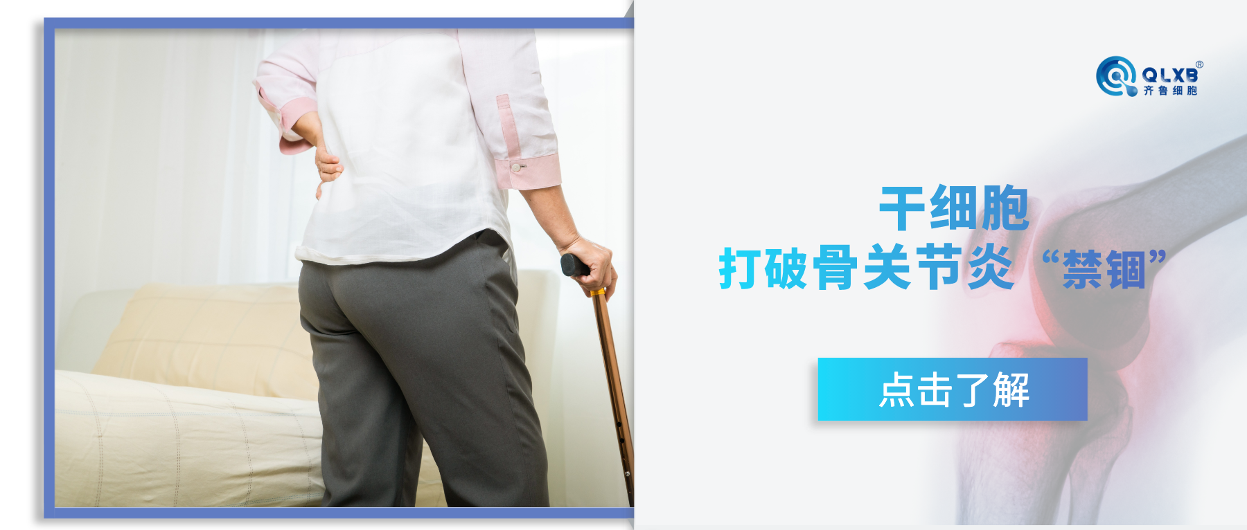 打破骨關(guān)節(jié)“禁錮” 干細胞在骨關(guān)節(jié)炎方向的應(yīng)用研究 打破骨關(guān)節(jié)“禁錮” 干細胞在骨關(guān)節(jié)炎方向的應(yīng)用研究