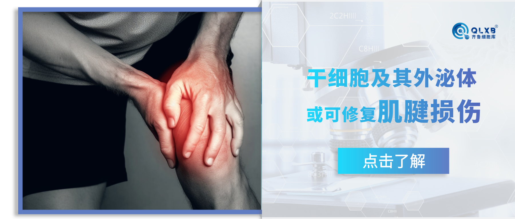 科普日常 | MSCs及其外泌體：或可修復肌腱損傷