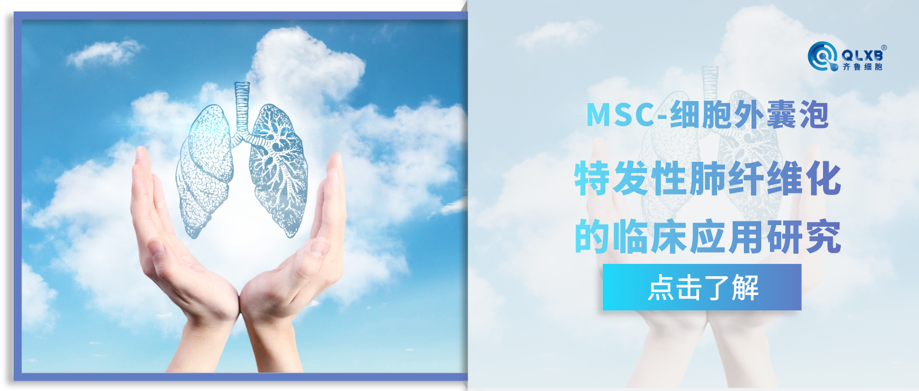 科普日常 | 間充質(zhì)干細胞來源細胞外囊泡在特發(fā)性肺纖維化方向的臨床應(yīng)用研究 科普日常 | 間充質(zhì)干細胞來源細胞外囊泡在特發(fā)性肺纖維化方向的臨床應(yīng)用研究