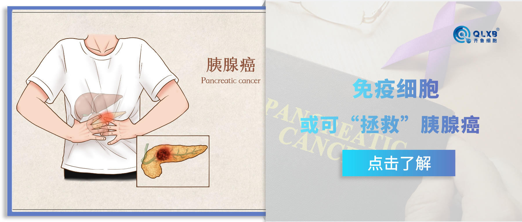 “腫瘤縮小72%！”，免疫細胞療法讓胰腺癌的治療擁有更多可能