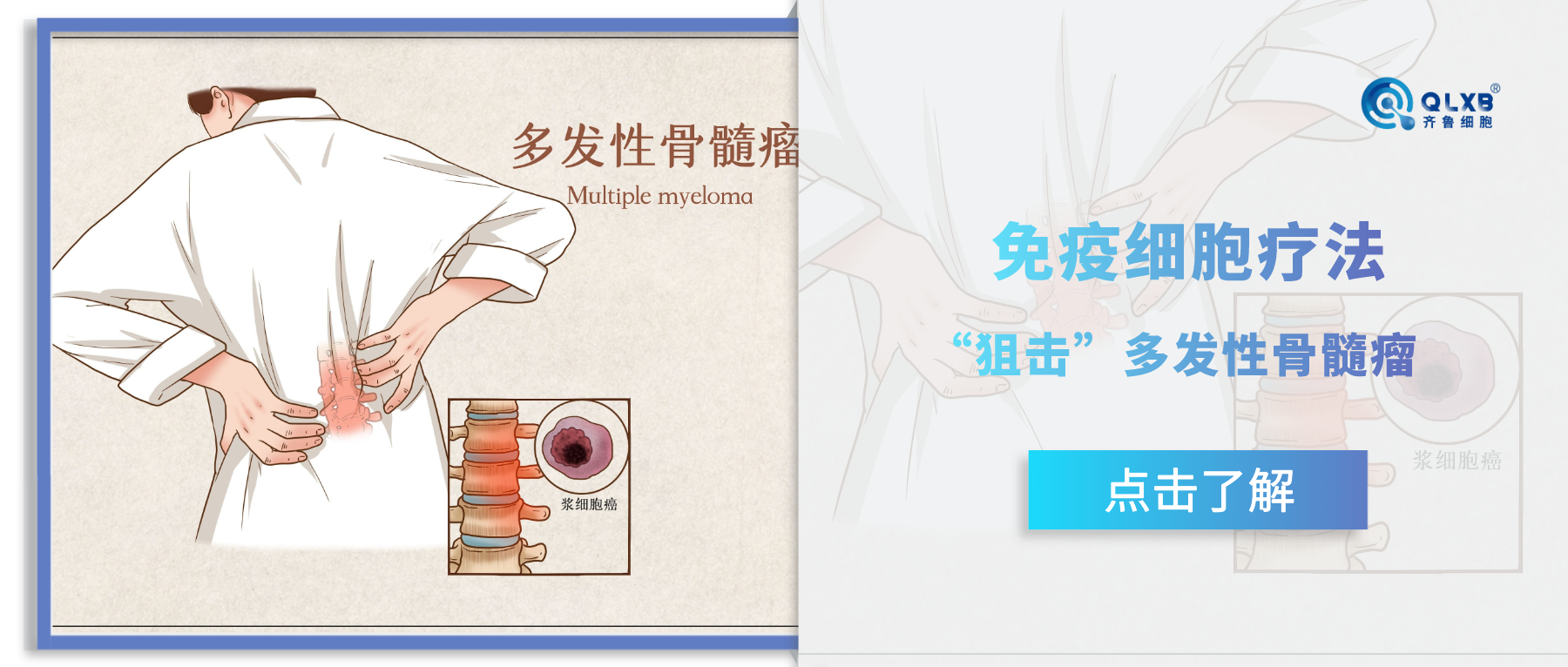 科普日常 | 免疫細(xì)胞療法狙擊“偽裝高手”多發(fā)性骨髓瘤 科普日常 | 免疫細(xì)胞療法狙擊“偽裝高手”多發(fā)性骨髓瘤