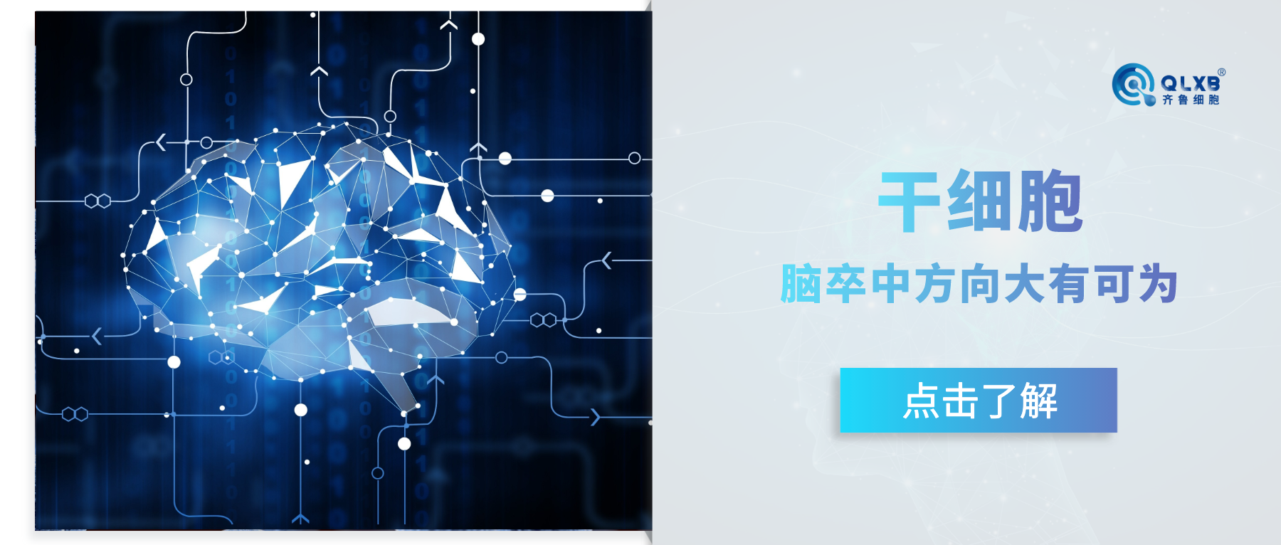 案例分享 | 新希望！干細胞在腦卒中方向的臨床潛力值得期待