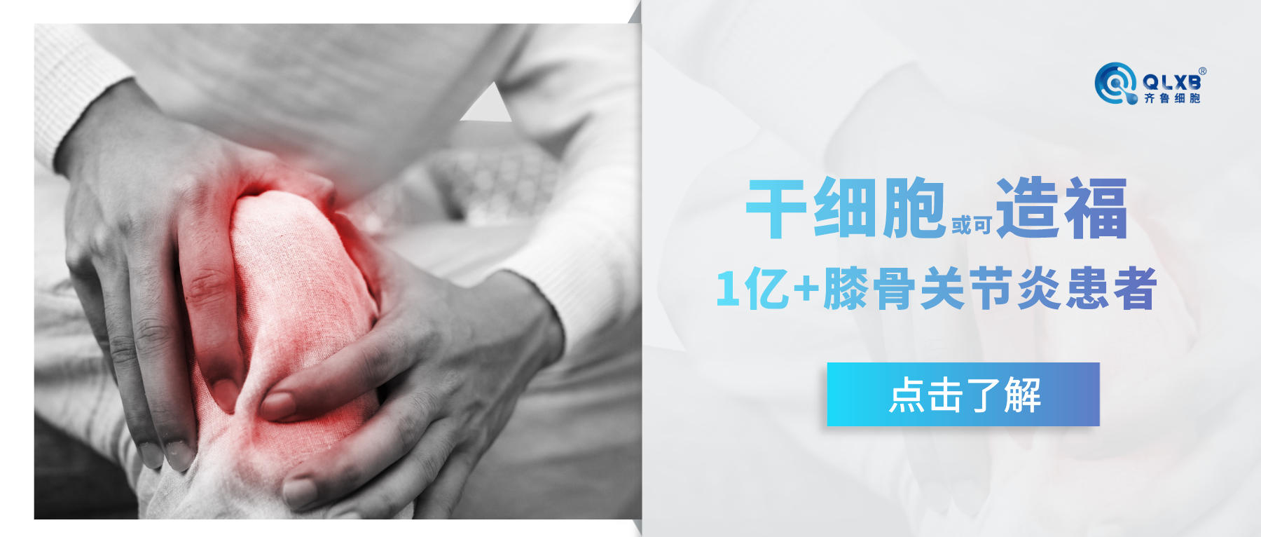 案例分享 | 干細胞或可造福超1億膝骨關節炎患者