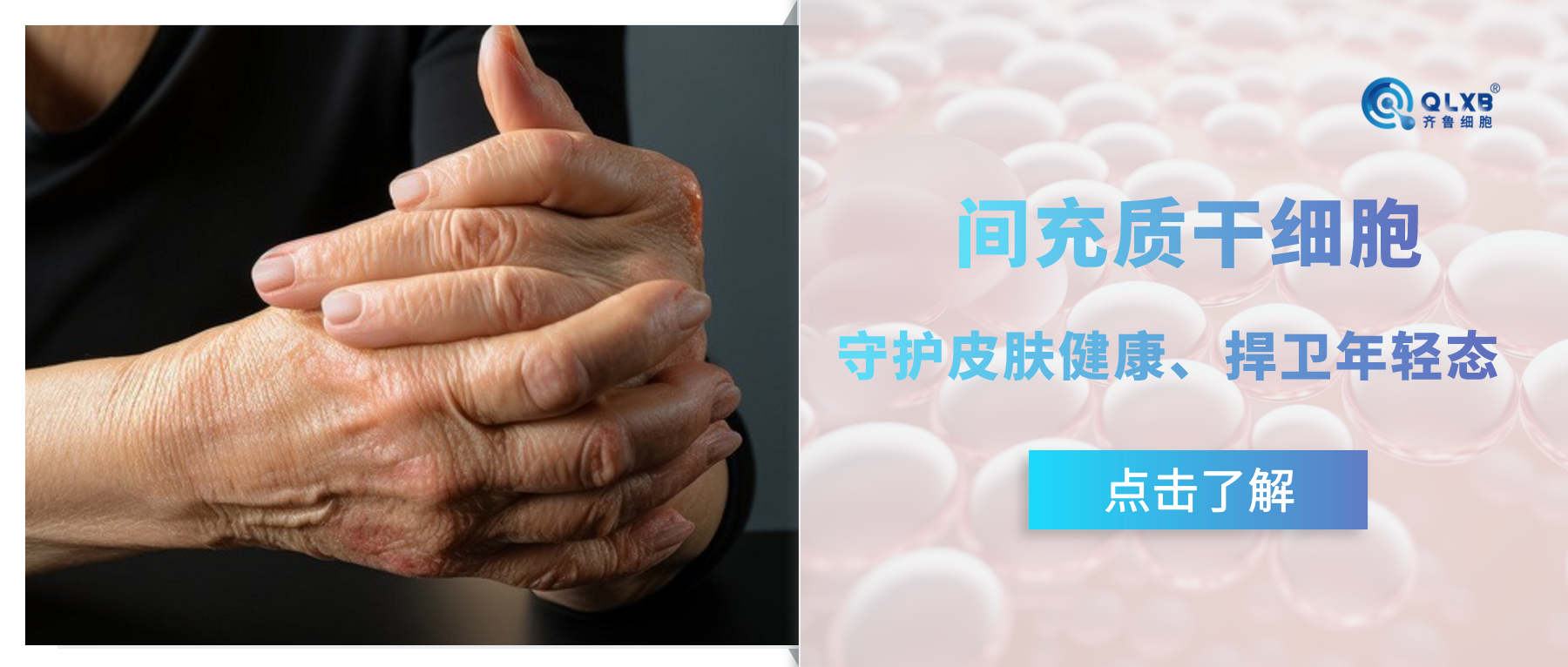 案例分享 | 皮膚健康和年輕態的“守護者”—間充質干細胞