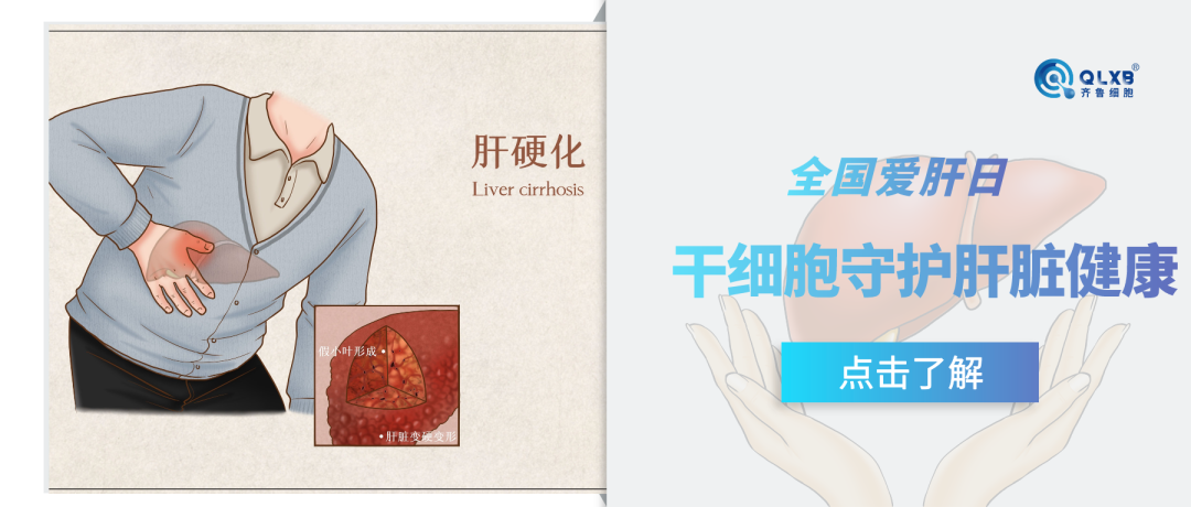 全國愛肝日 | 助力“遠離”肝硬化 ，干細胞技術守護肝臟健康
