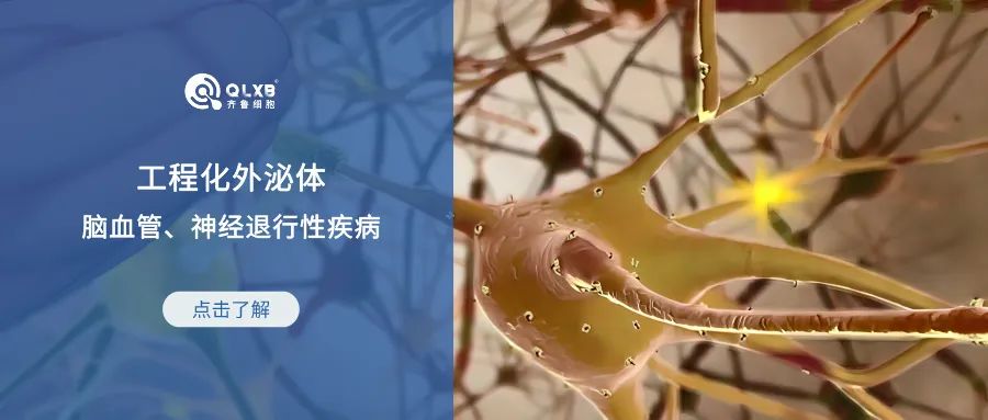 科普日常 | 工程化外泌體用于腦血管和神經退行性疾病的治療