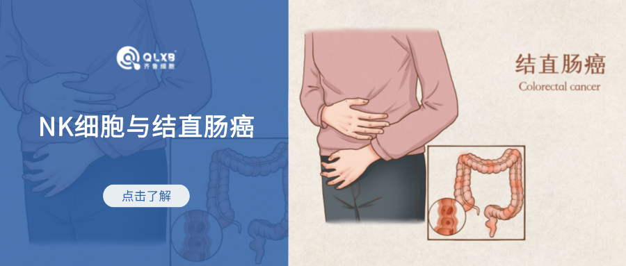 NK細胞活性高低與患結(jié)直腸癌的風(fēng)險相關(guān),或可成為應(yīng)對新思路。 NK細胞活性高低與患結(jié)直腸癌的風(fēng)險相關(guān),或可成為應(yīng)對新思路。