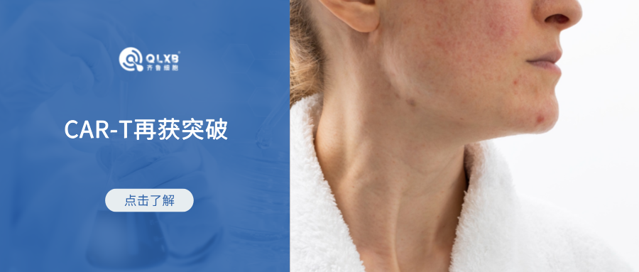 前沿資訊 | CAR-T再取得突破，20名難治性紅斑狼瘡患兒停用激素及免疫制劑