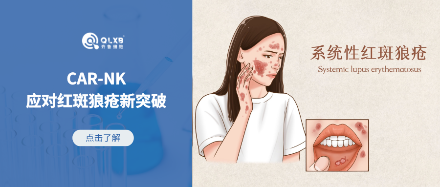 “CAR”技術(shù)新可能，應(yīng)對紅斑狼瘡再獲新突破