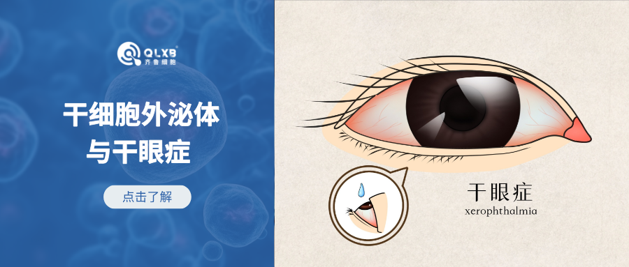 175篇論文系統綜述：干細胞外泌體在應對干眼癥方向具有一定潛力