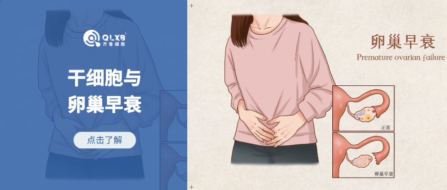 案例分享 | 卵巢早衰影響女性健康,干細胞守護卵巢健康態 案例分享 | 卵巢早衰影響女性健康,干細胞守護卵巢健康態