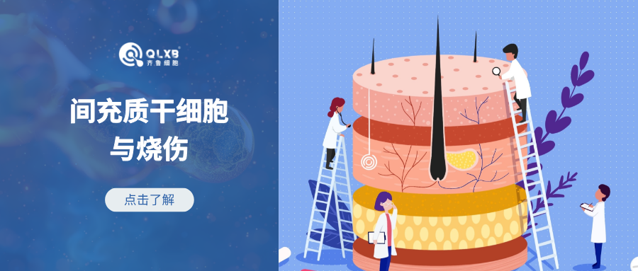 科普日常 | 間充質(zhì)干細胞在燒傷領(lǐng)域的應(yīng)用前景