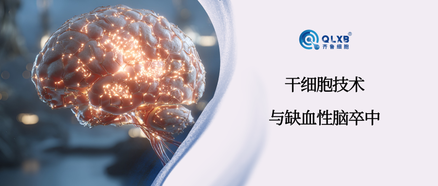 案例分享 | 592名受試者:干細胞技術降低缺血性中風死亡率 案例分享 | 592名受試者:干細胞技術降低缺血性中風死亡率