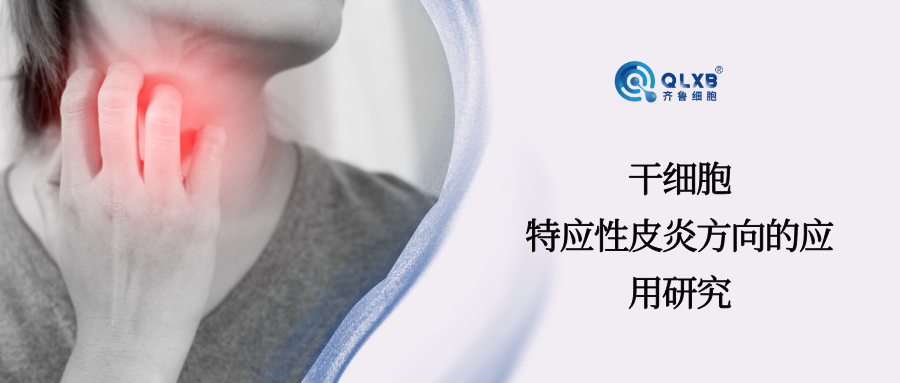 案例分享 | 干細胞，應(yīng)對特應(yīng)性皮炎的新希望