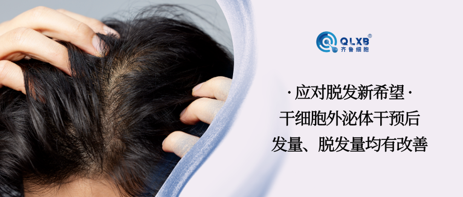 案例分享 | 應對脫發新希望，干細胞外泌體干預后，脫發量、發量均改善