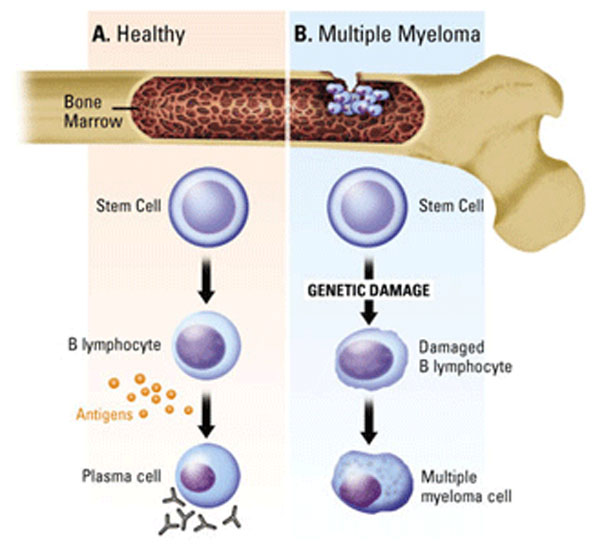 免疫細(xì)胞儲(chǔ)存 免疫細(xì)胞儲(chǔ)存