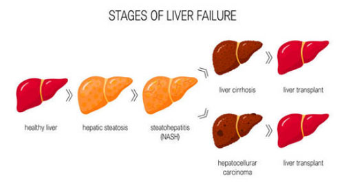 成人脂肪干細胞儲存 成人脂肪干細胞儲存