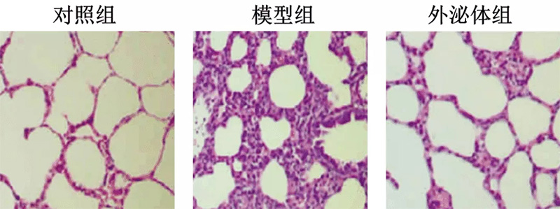 自體細(xì)胞儲(chǔ)存 自體細(xì)胞儲(chǔ)存