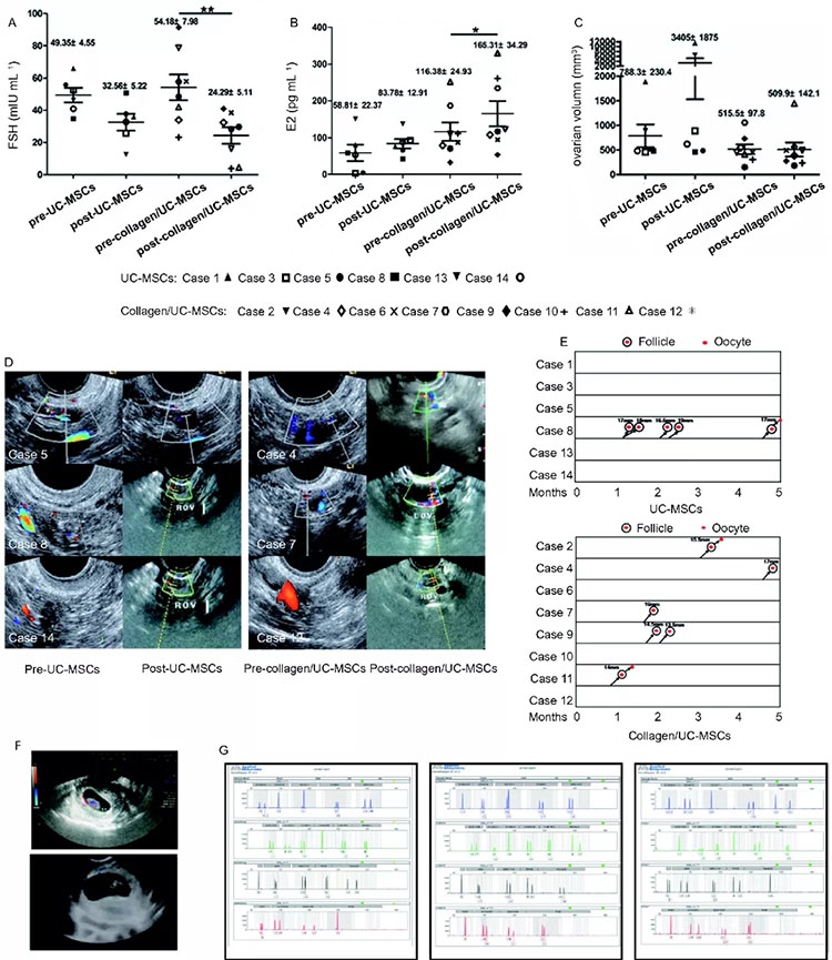 自體脂肪干細胞儲存 自體脂肪干細胞儲存