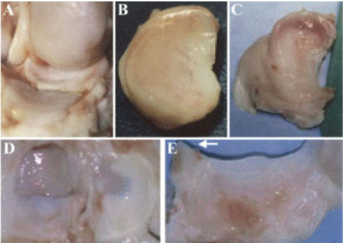 自體脂肪干細胞儲存 自體脂肪干細胞儲存
