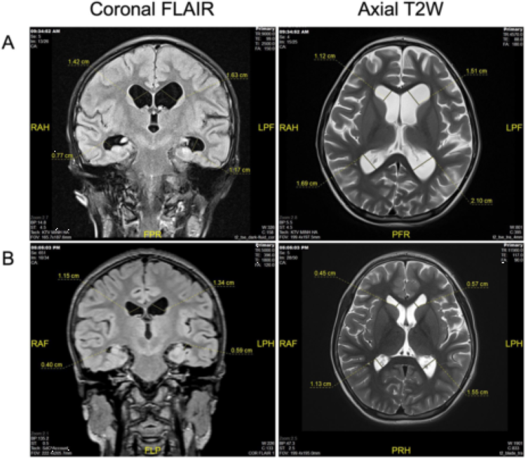 干細胞儲存 干細胞儲存