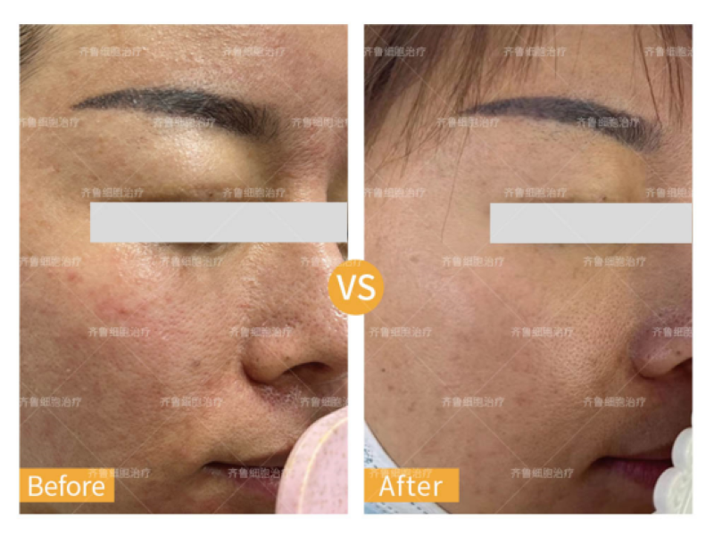 肌因世家 肌因世家