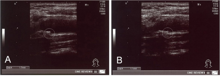 de1e8148f146865ae5a8d2db74500c16 de1e8148f146865ae5a8d2db74500c16